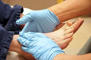 Diabetic Foot Care