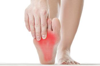 Plantar Fasciitis