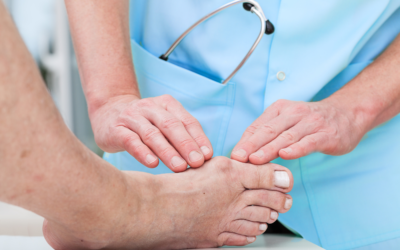 Why Do Bunions Get Worse Over Time?