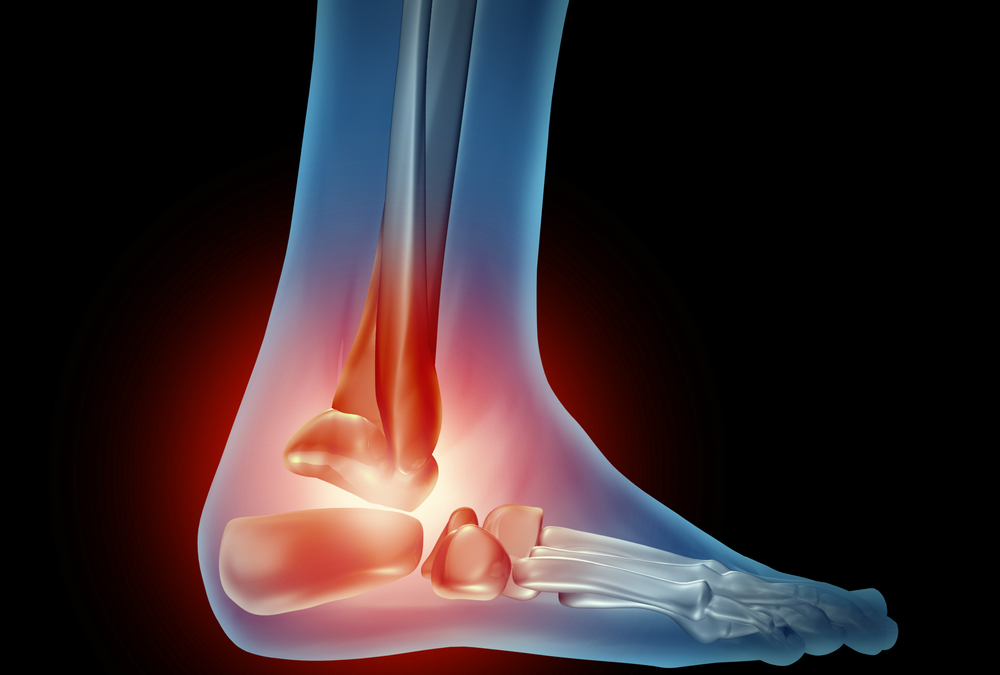 What Are the Causes of Arthritis in the Foot?