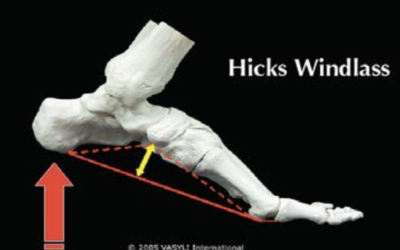 Functional Hallux Limitus (Fhl)